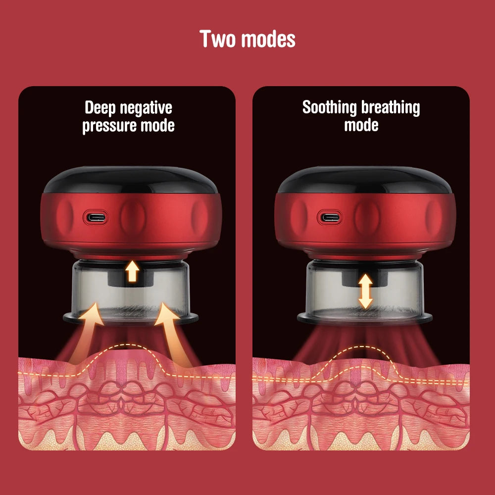 Smart Electric Body Cupping Massager – Heated Vacuum Scraping Therapy Device for Back, Neck & Arm Relief 🔥👐